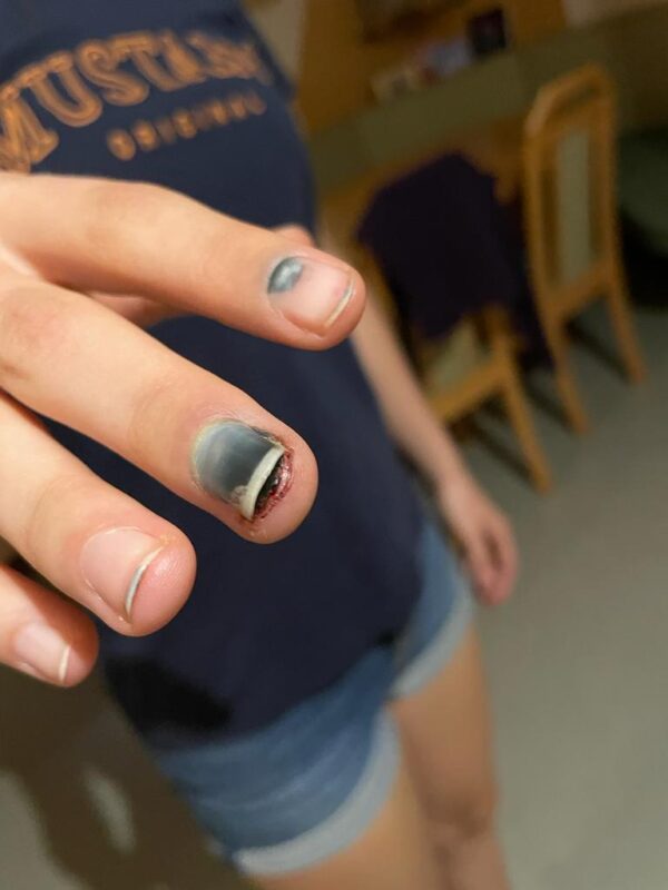 vanessa finger 2