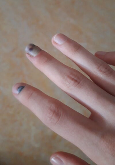 vanessa finger 3